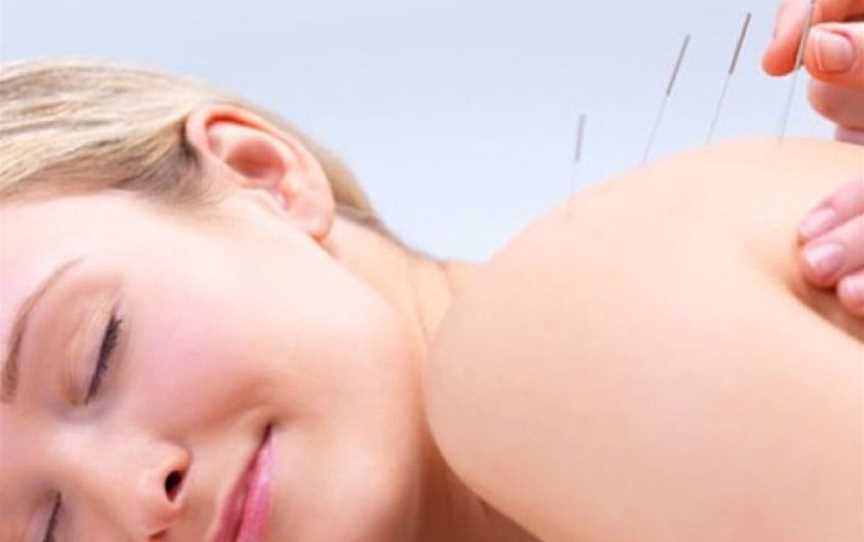 Facial Rejuvenation Acupuncture, Shopping & Wellbeing in Scarborough
