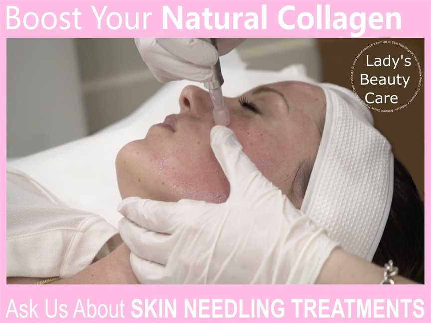 Skin Needling